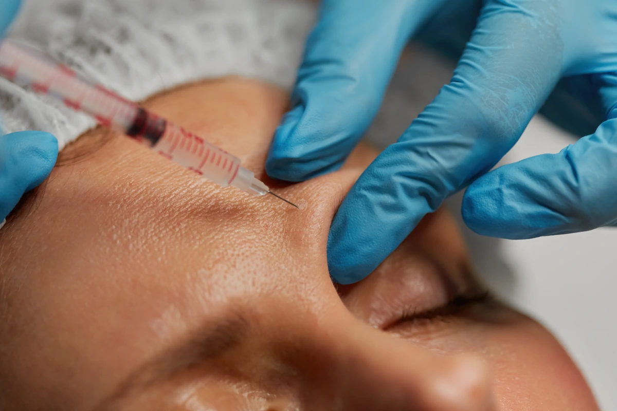 Une personne qui se fait faire une piqûre de botox