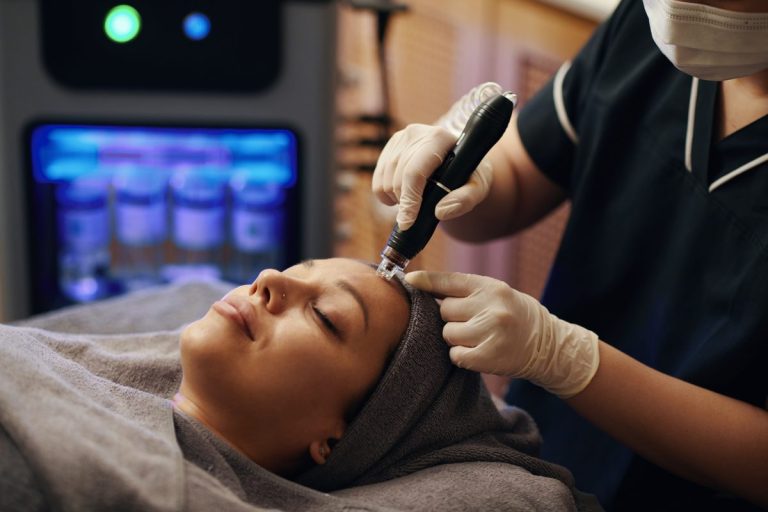 Microneedling à la maison : bonne idée ou fausse économie ?